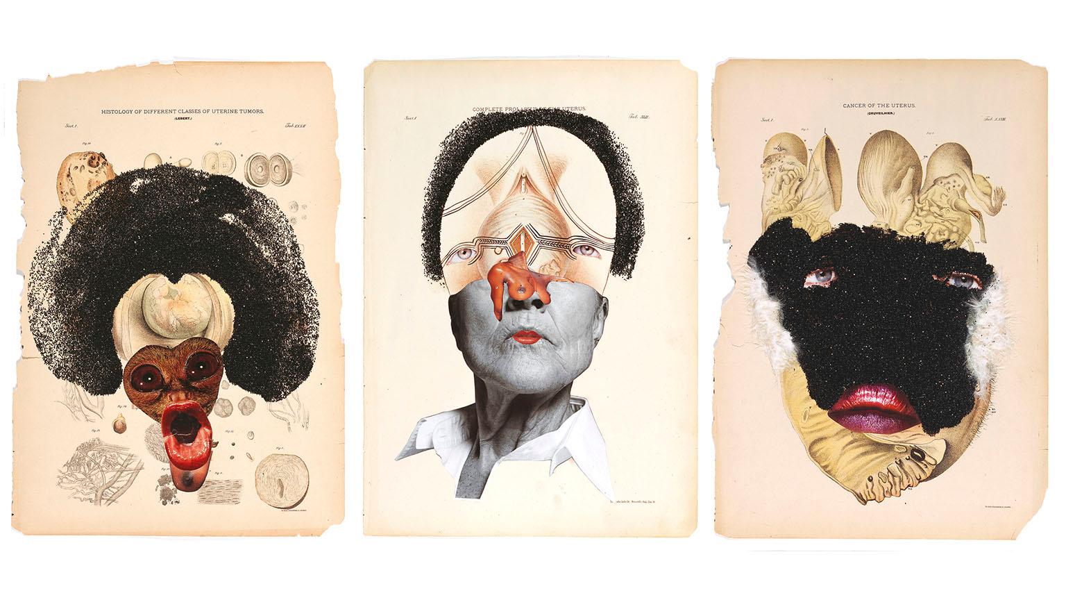 Wangechi Mutu, Histology of the Different Classes of Uterine Tumors