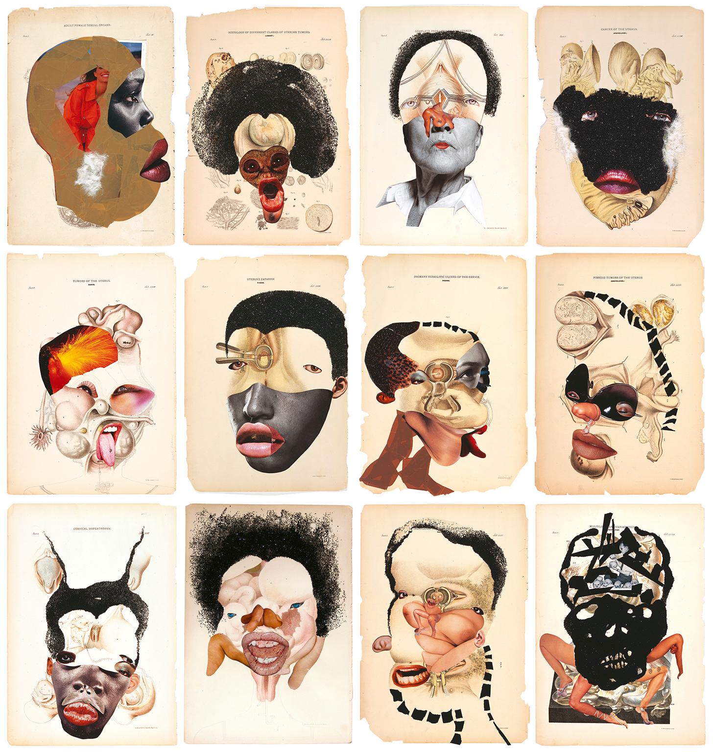 Wangechi Mutu, Histology of the Different Classes of Uterine Tumours, 2004-5, Scottish National Gallery of Modern Art, Art Funded 2020